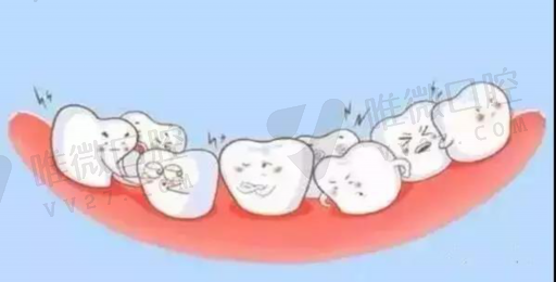 做牙套和假牙有什么区别,镶牙要戴牙套吗(图1)